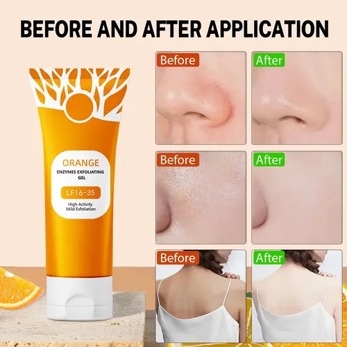 Gel Exfoliante Miehoous Orange Para Rostro Y Cuerpo 100g X2