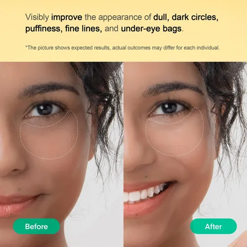 Drparches Para Ojeras Fdgdfterez & Honor Para Debajo De Los