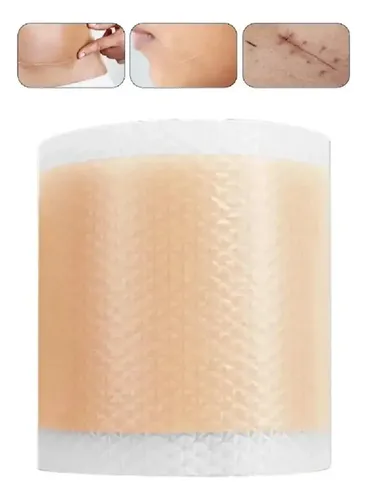 Rollo de Parche de Silicona para Eliminar Cicatrices y Queloides 1.5Mts