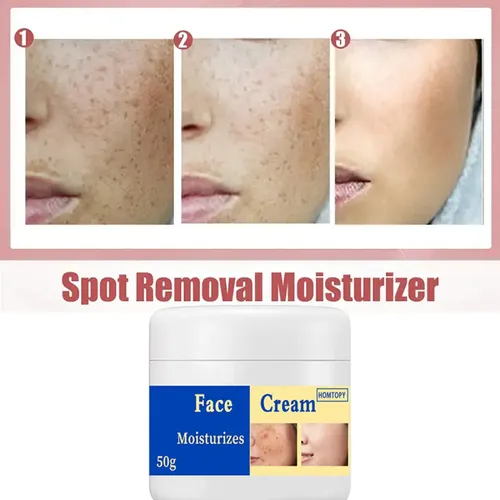 Crema Iluminadora Para Manchas Y Pigmentación