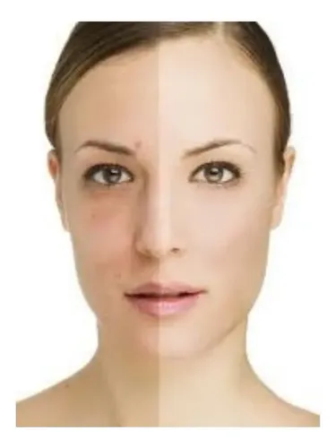 Reparador Intensivo De Ojeras Idraet Sublime Eyes Peptides