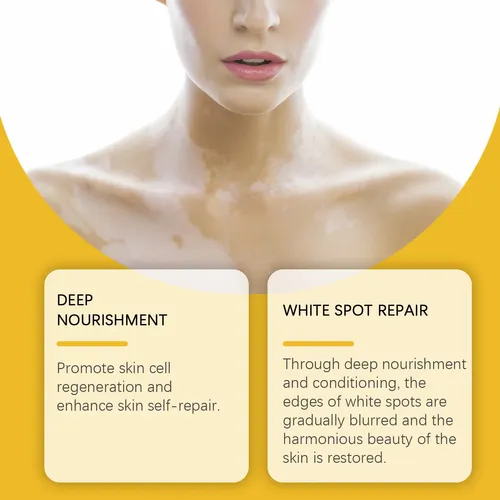 Crema Para El Cuidado De La Piel Para Manos, Pies Y Cuerpo,