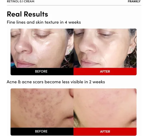 Crema Retinol 0.3% Frankly 20ml Anti-edad Coreana