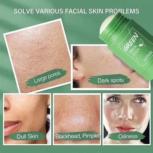 Mascarilla De Arcilla, Té Verde Elimina Puntos Negros, Acné