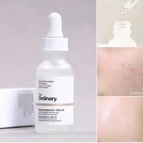 Sérum Niacinamida 10% + zinc 1% The Ordinary día/noche para todo tipo de piel de 60mL/60g +15 años