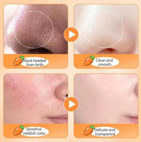 Mascarilla Facial De Zanahoria Espuma X12 Und Sadoer