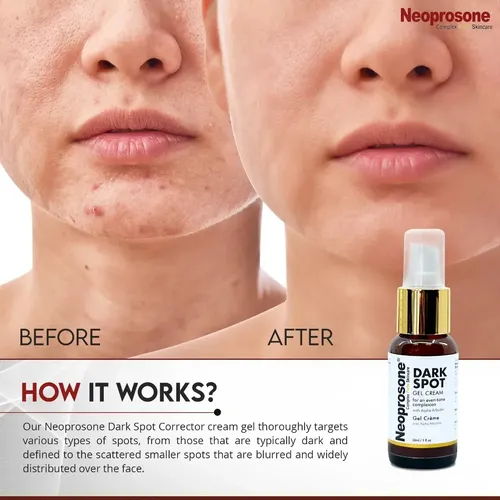 Crema Hidratante En Gel De Neoprosona Que Aclara Las Manchas Todo Tipo De Piel Día/noche