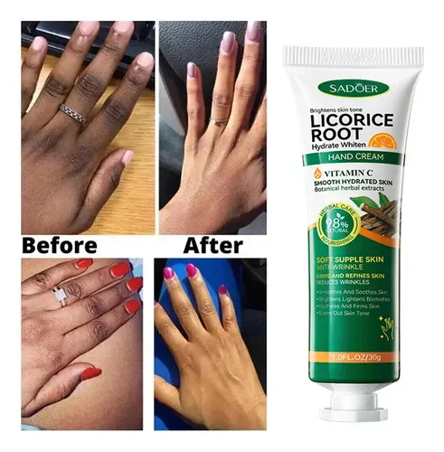 Crema Blanqueadora Y Abrillantadora Knuckles Fastx