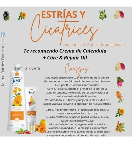 Crema De Caléndula Just Atenúa Estrías 25 Gramos
