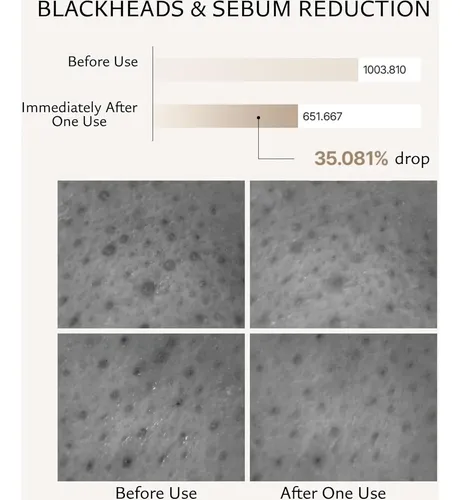 Bálsamo Limpiador Suave Mild Me Para Rostro (arroz)
