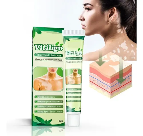 Y 4crema For Vitíligo Crema For Quitar Las Manchas Y
