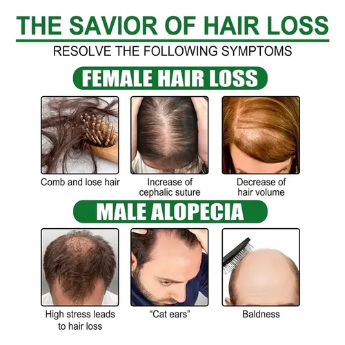 W El Sérum Para El Crecimiento Del Cabello Promueve El W