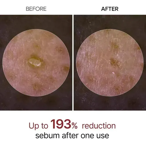 B.exfoliante Suave Para Rostro Y Cuerpo Dr. Melaxin De 2 Bot