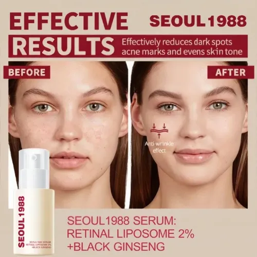 Serum Reparador + Crema De Ojos Seoul1988 Antiedad Todo