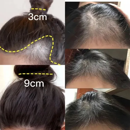 Aceite Esencial De Jengibre Para Cabello, Anticaída, Para El