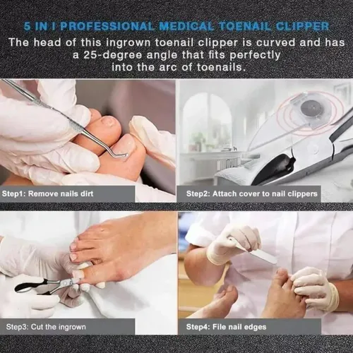 – Set De Pedicura Y Cortaúñas De Acero Inoxidable =