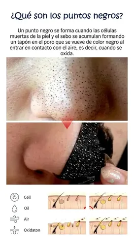 Bandas X30 Depilacion Facial +3 Mascarilla Puntos Negros Kit