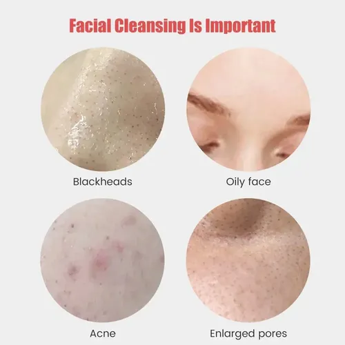 Cepillo Limpiador Facial Impermeable Sonic Para Hombres Y Ri