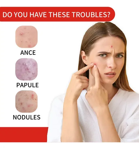 Parches Para El Acné Mq Acne Pimple Patch 200u Todo Tipo De Piel
