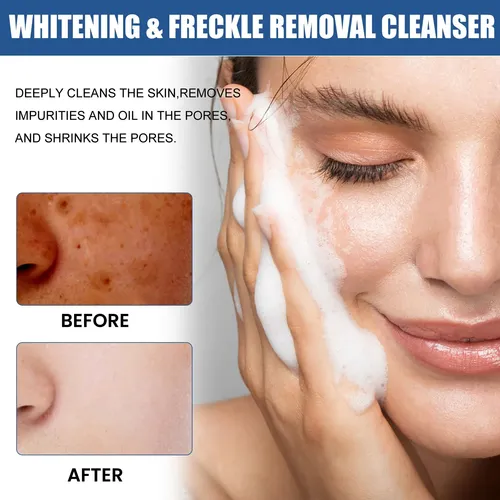 Pmlimpiador Facial Hidratante Suave: Gel De Limpieza Facial@