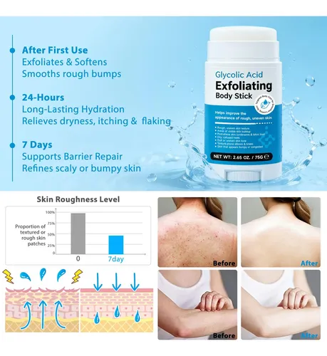 Body Stick With Glycolic Acid, Solid Non-sticky No Resin