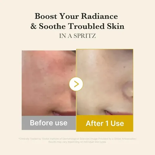 Medicube Kojic Acid Turmeric Vitamin Gold Jelly Mist Serum Todo Tipo De Piel Día/noche