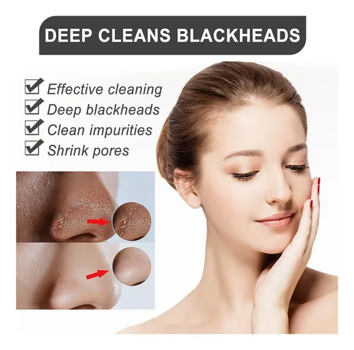 Peppermint Aloe Pore Strips,clean Blackheads And Oil