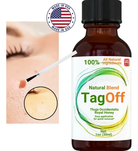 Removedor / Quita Verrugas Tag Off Skin Tag Natural