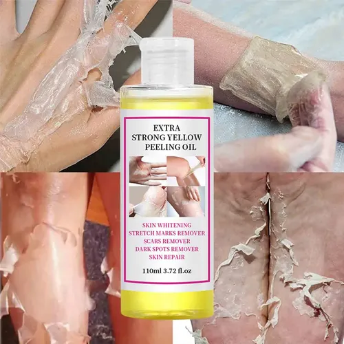 Aceite Exfoliante Amarillo Gextra Strength Para Blanquear La Piel