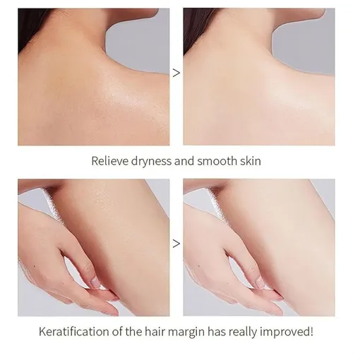 Exfoliante De Poros Profundos, Enzimas De Naranja, Geles Ele