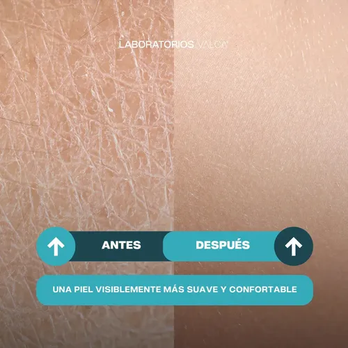 Crema Ultra Regeneradora Valca X 130g Momento De Aplicación Día/noche Tipo De Piel Todo Tipo De Piel