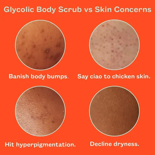 Exfoliante Corporal Glicólico Frank Body | Vegan, Cruelty Fr