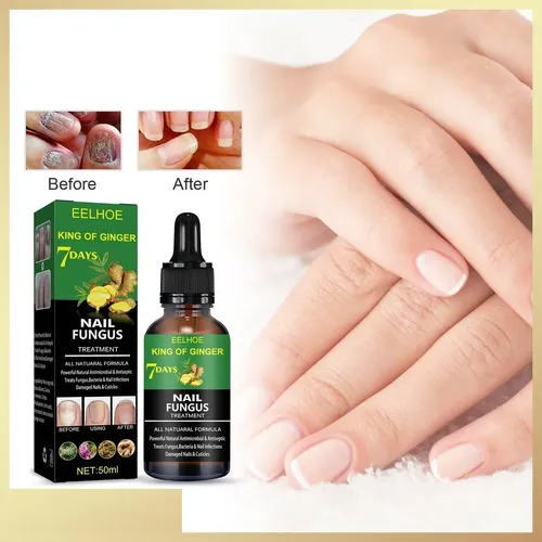 Suero Para Hongos En Las Uñas Para El Tratamiento De Uñaspd