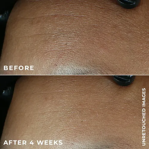 Roc |line Smoothing Max Hydrating Cream-retinol En Crema 48g Momento De Aplicación Día/noche Tipo De Piel Todo Tipo De Piel