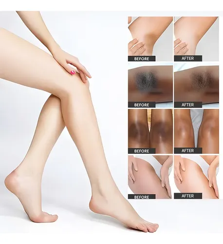 Crema Para Eliminar Manchas Oscuras En Áreas Íntimas, 30 Ml,