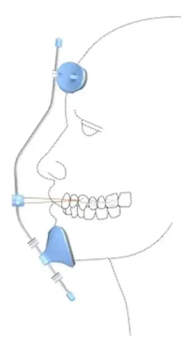 Máscara Facial Petit Azul 70.50.001 – Morelli
