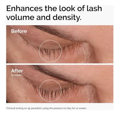 The Ordinary The Lip & Lash Set Lash & Brow Serum + Lip Balm