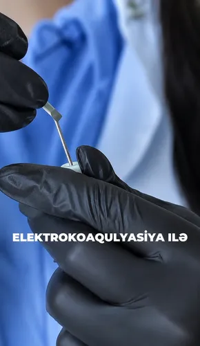 Máquina De Depilación Con Pinza Eléctrica D-901p Para Rostro