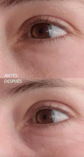 Serum Hidratante Y Proaging Rhift X 30 Ml. Todo Tipo De Piel