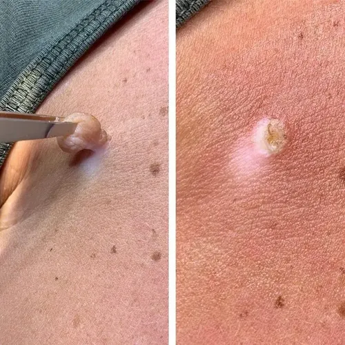 Crema Para La Eliminación Instantánea De Manchas Removedor