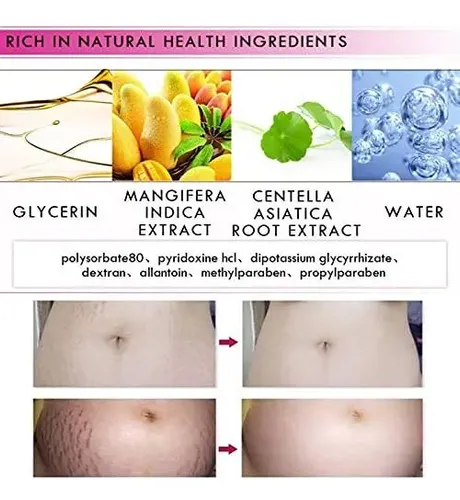 Crema Hidratante Para Estrías Y Cicatrices Yg Liankai 40g