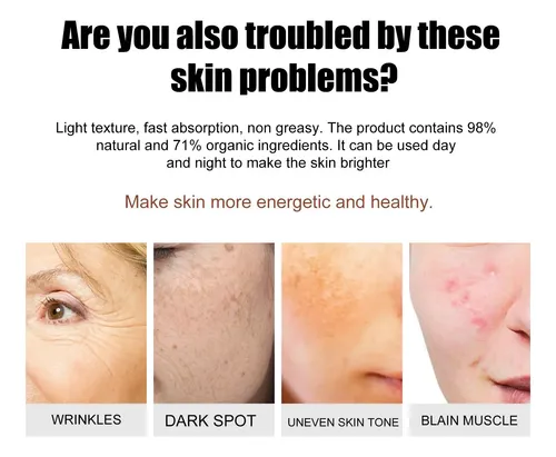 Útil Crema Blanqueadora Y Antipecas, Hidratante Y Antiarruga