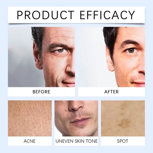 Tónico Facial Para Hombre East Moon, Hidratante Y Refrescant