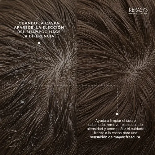 Shampoo Scalp Deep Cleansing 180ml