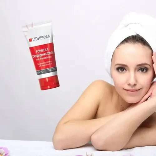 Crema Blanqueadora Fórmula Despigmentante Manchas Lidherma