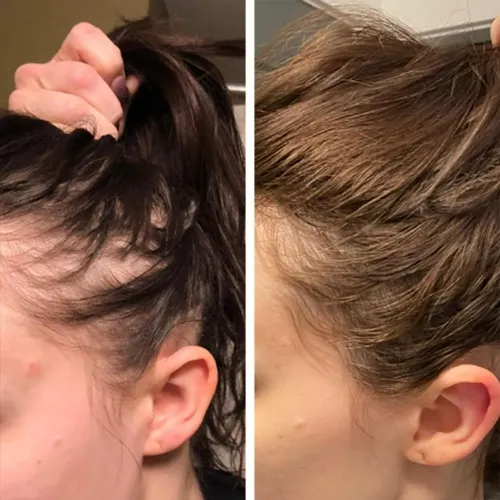 Aceite Para El Crecimiento Y Tratamiento Del Cabello Vvd Ros
