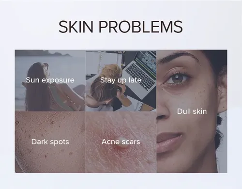 Crema De Noche Laikou Antimanchas Y Pecas – Niacinamida