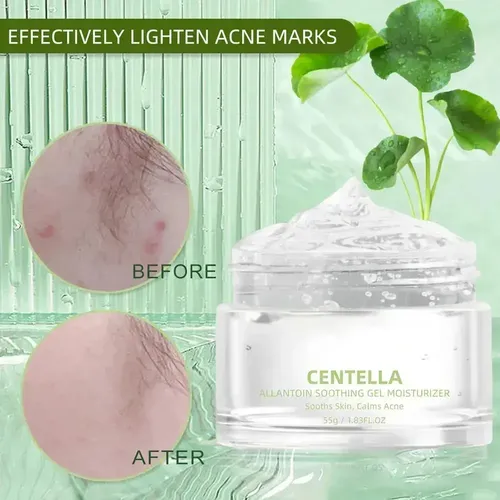 Aq Gel Hidratante Centella Para Pieles Grasas Y Antiacné Xz