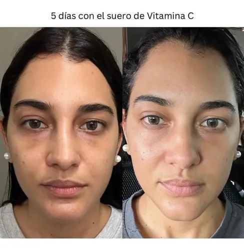 Vitamina C Glow Serum Farmasi, Suero Reductor Manchas Piel Momento De Aplicación Día/noche Tipo De Piel Sensible