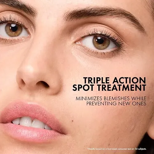 Tratamiento Corrector De Acne Vichy Normaderm Sos 156104 Con